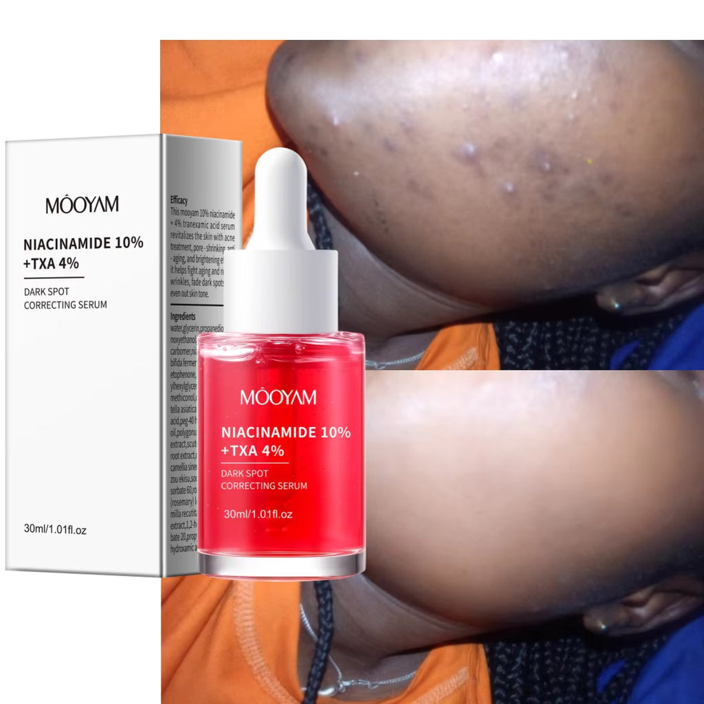Mooyam Niacinamide 10% + TXA 4% Dark Spot Correcting Serum, 30ml