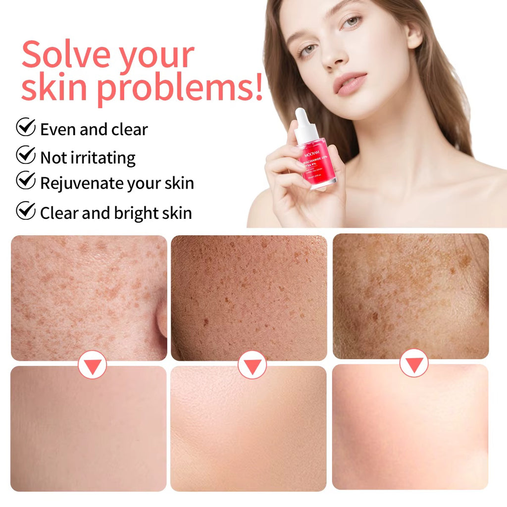 Mooyam Niacinamide 10% + TXA 4% Dark Spot Correcting Serum, 30ml