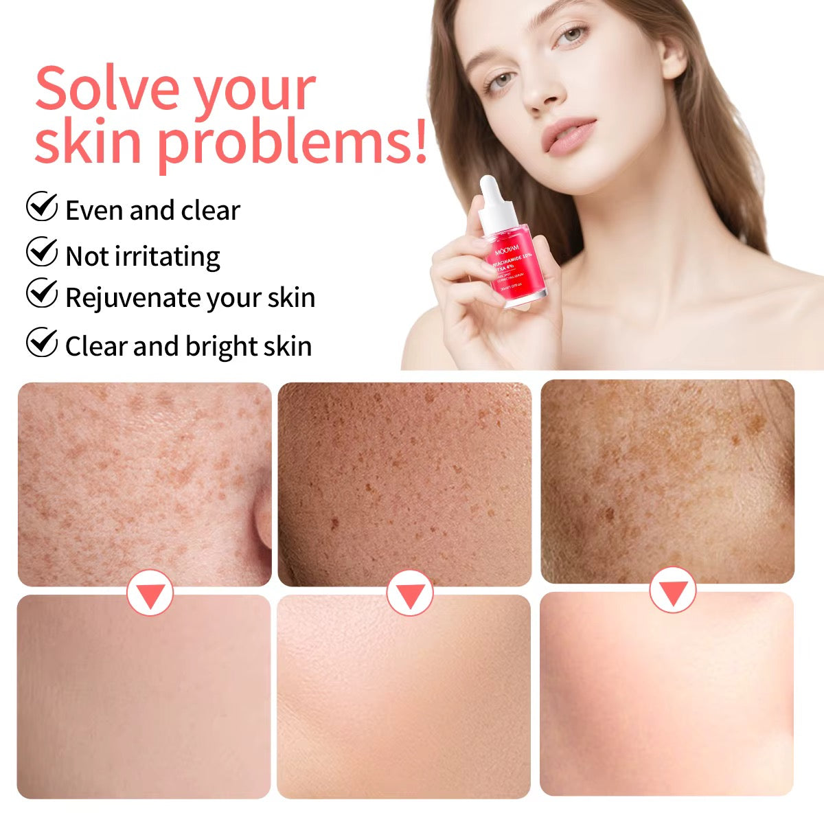 Mooyam Niacinamide 10% + TXA 4% Dark Spot Correcting Serum, 30ml